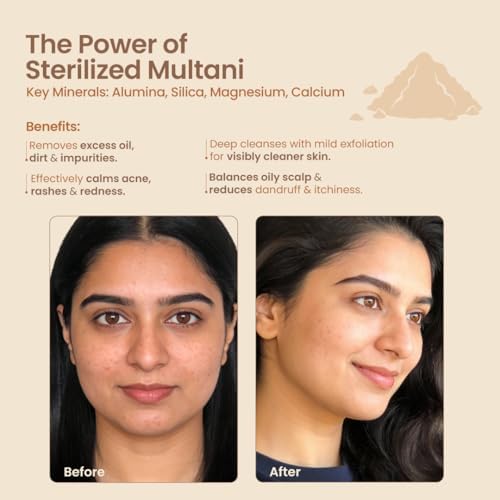 Nat Habit Multani Mitti Powder 200g – Natural Skincare Clay